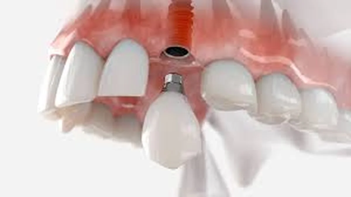 Close-up of a confident natural smile showing healthy teeth